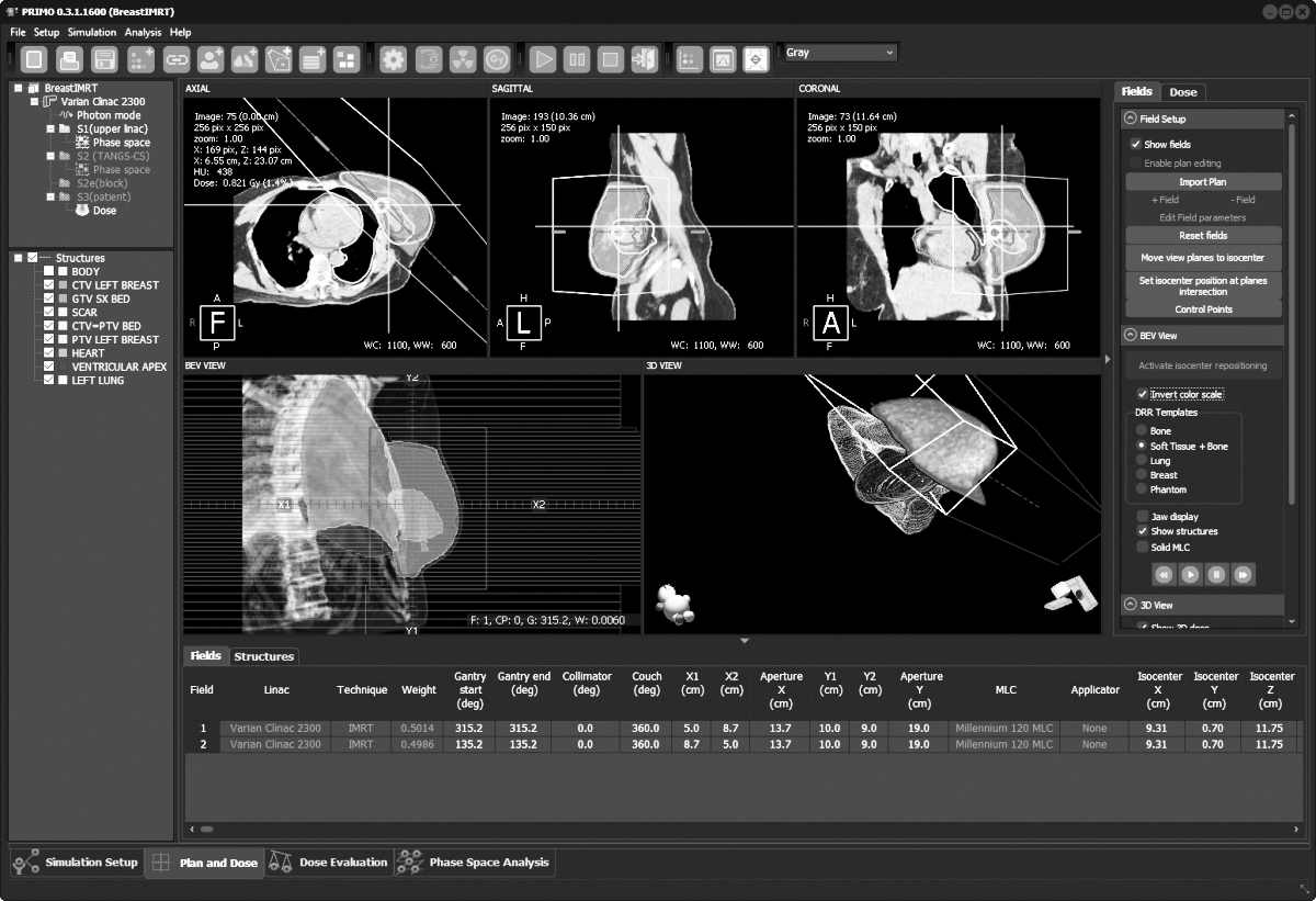 Breast-IMRT Breast-IMRT